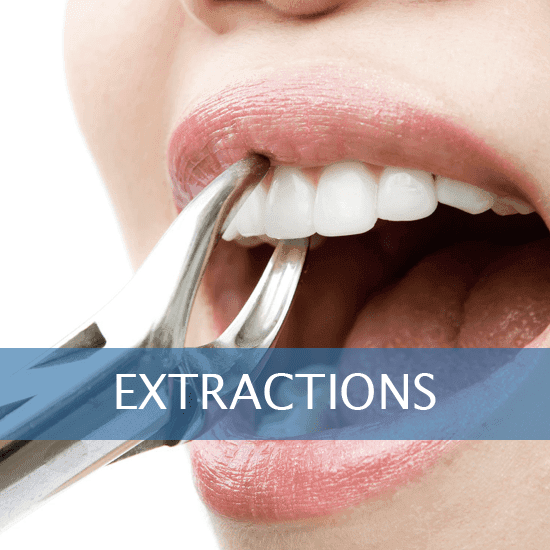 Extractions Friendly Dental of Worcester
