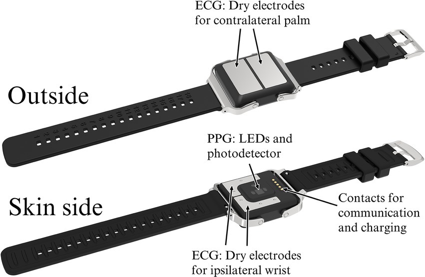 Frontiers Wristworn device combining PPG and ECG can be reliably
