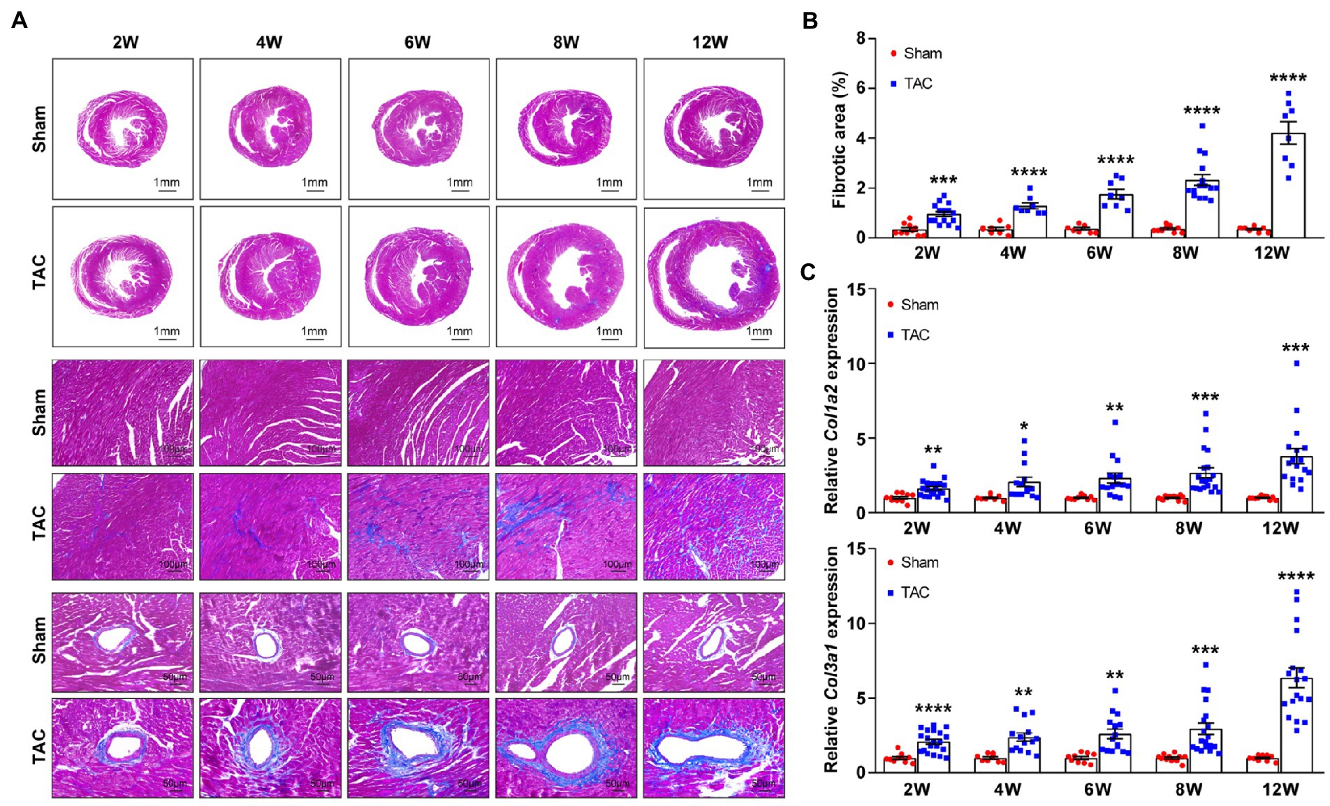 A timeseries minimally invasive transverse aortic constriction mouse