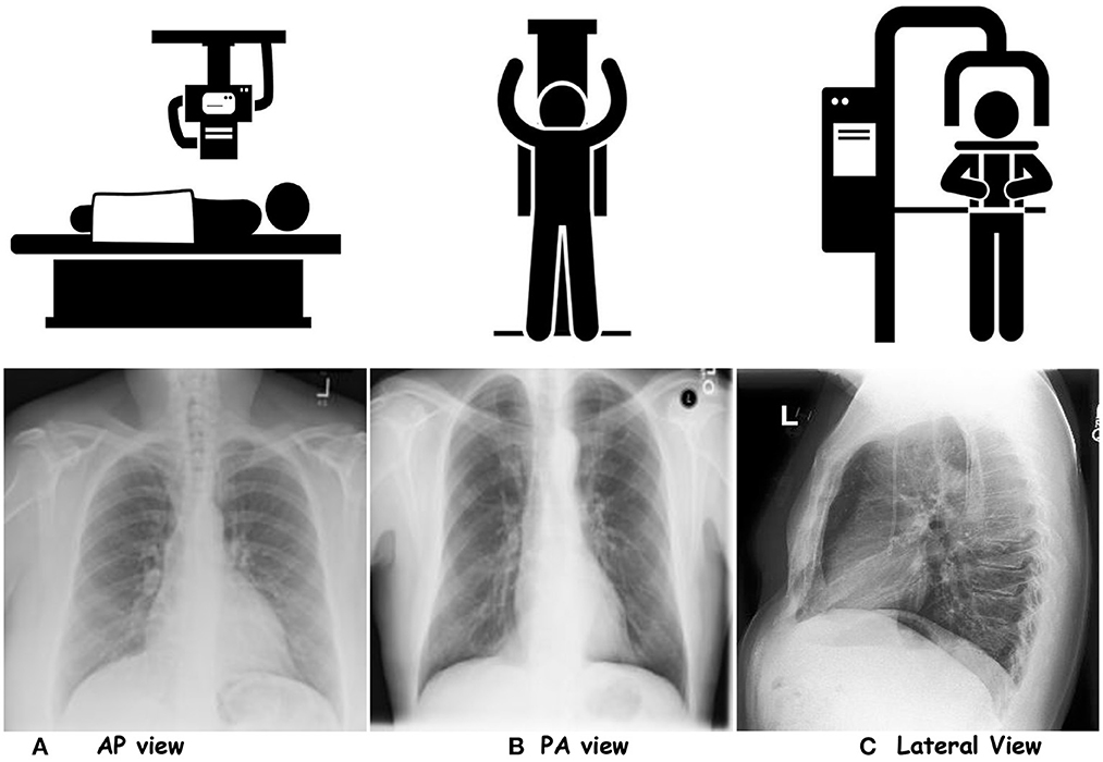 Frontiers AIbased radiodiagnosis using chest Xrays A review
