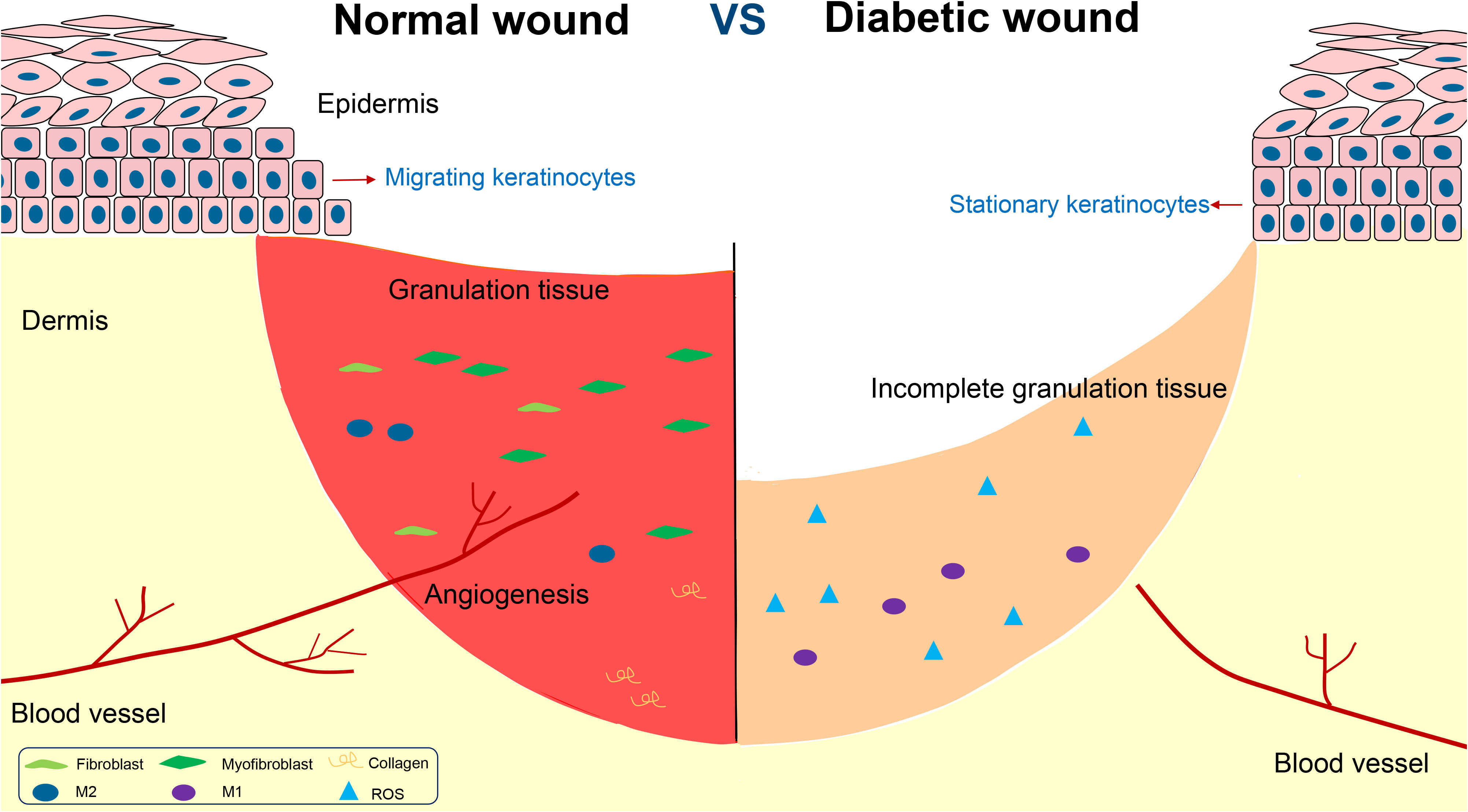 Frontiers The role of mesenchymal stem cellderived EVs in diabetic