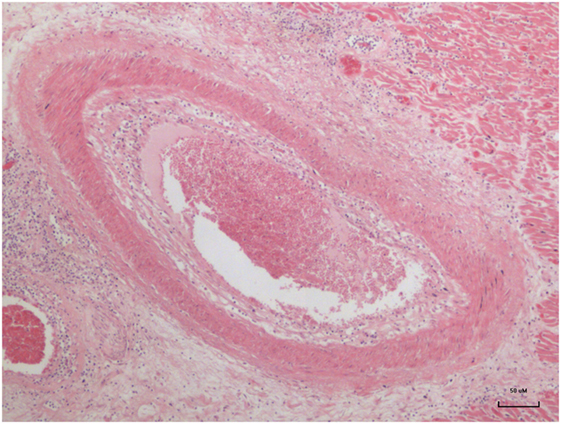 Frontiers Multiple Infectious Agents and the Origins of