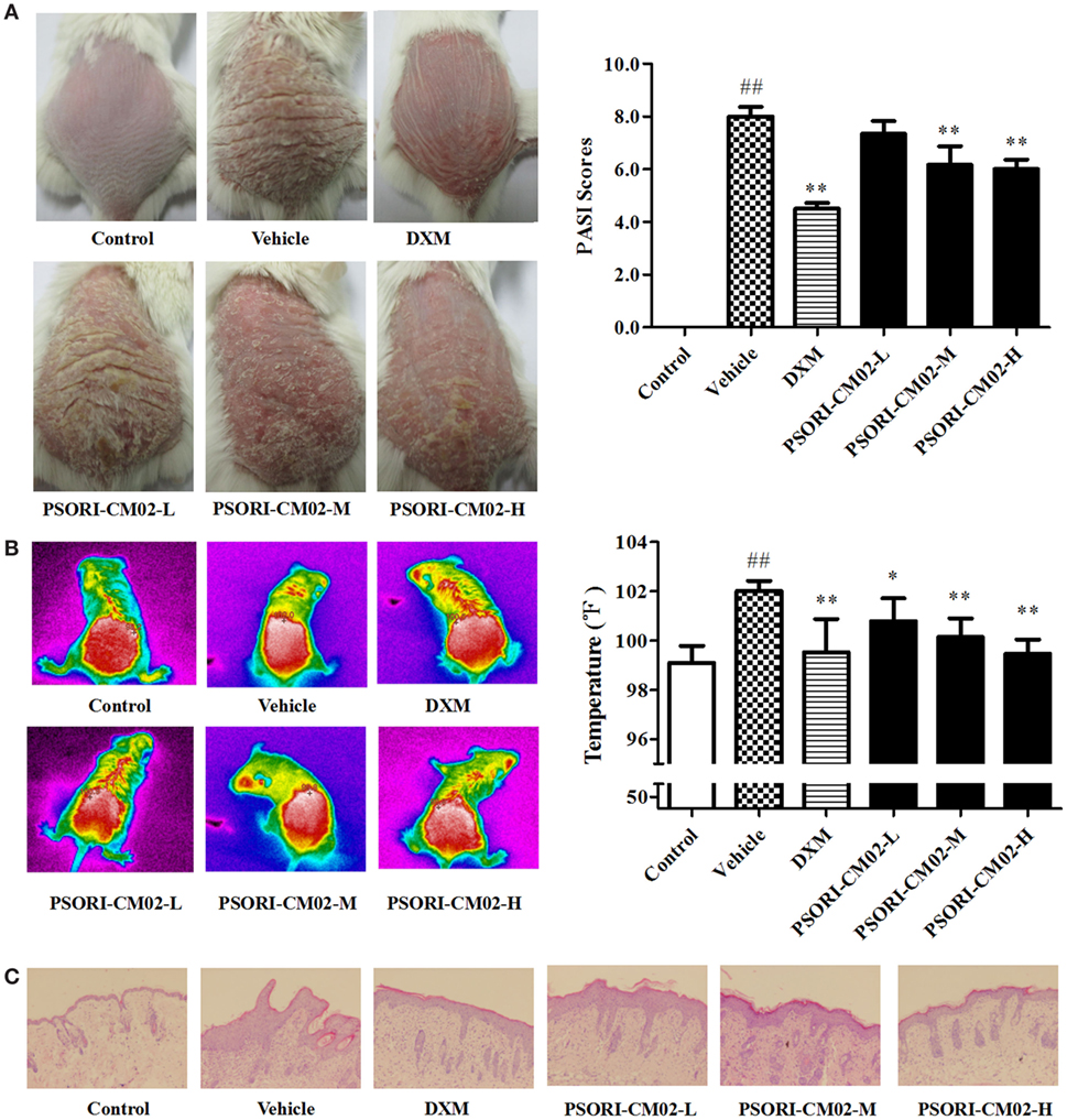 Frontiers PSORICM02 Formula Increases CD4+ Foxp3+ Regulatory T Cell