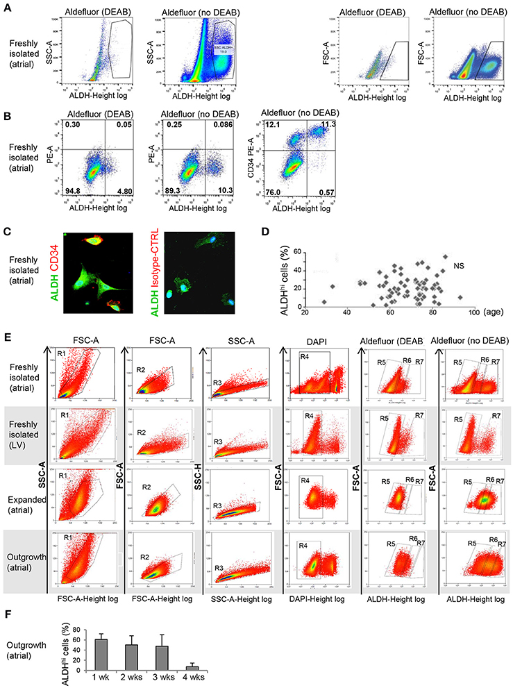 Frontiers ALDH1A3 Is the Key Isoform That Contributes to Aldehyde