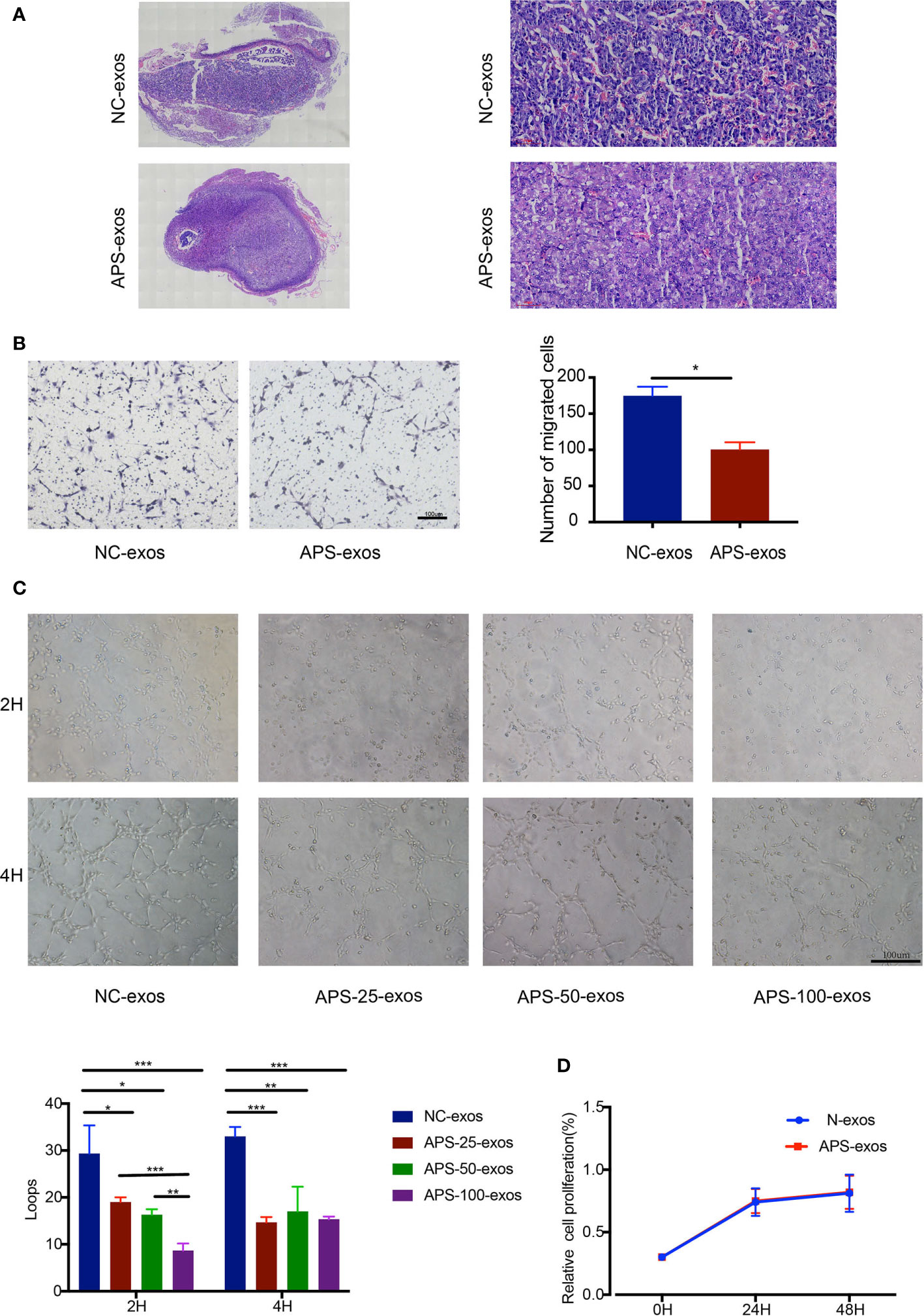 Frontiers ExosomeContained APOH Associated With Antiphospholipid Syndrome Immunology