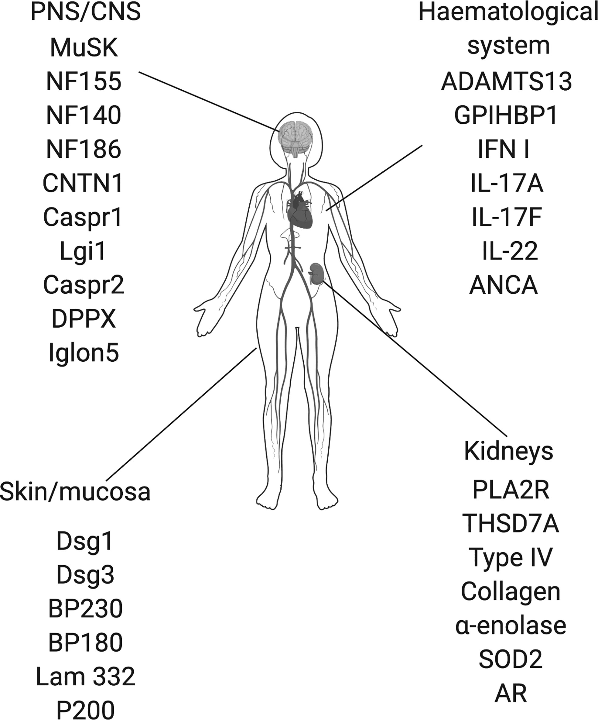 Myasthenia Gravis Represents A Type Of Disease Called Captions Omega