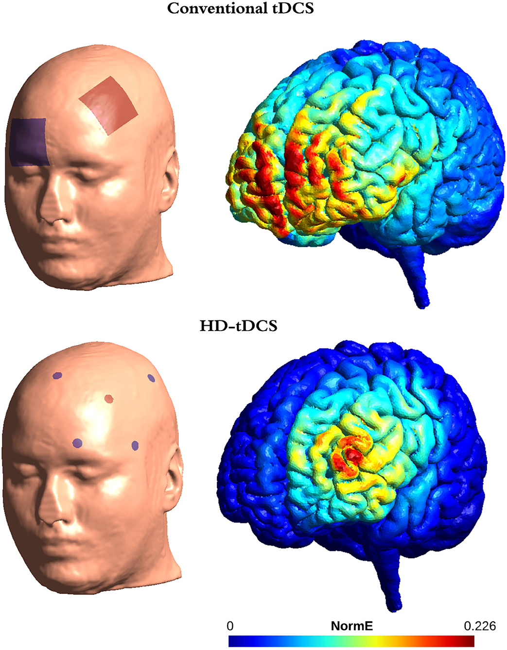 Frontiers Therapeutic Use of Transcranial Direct Current Stimulation