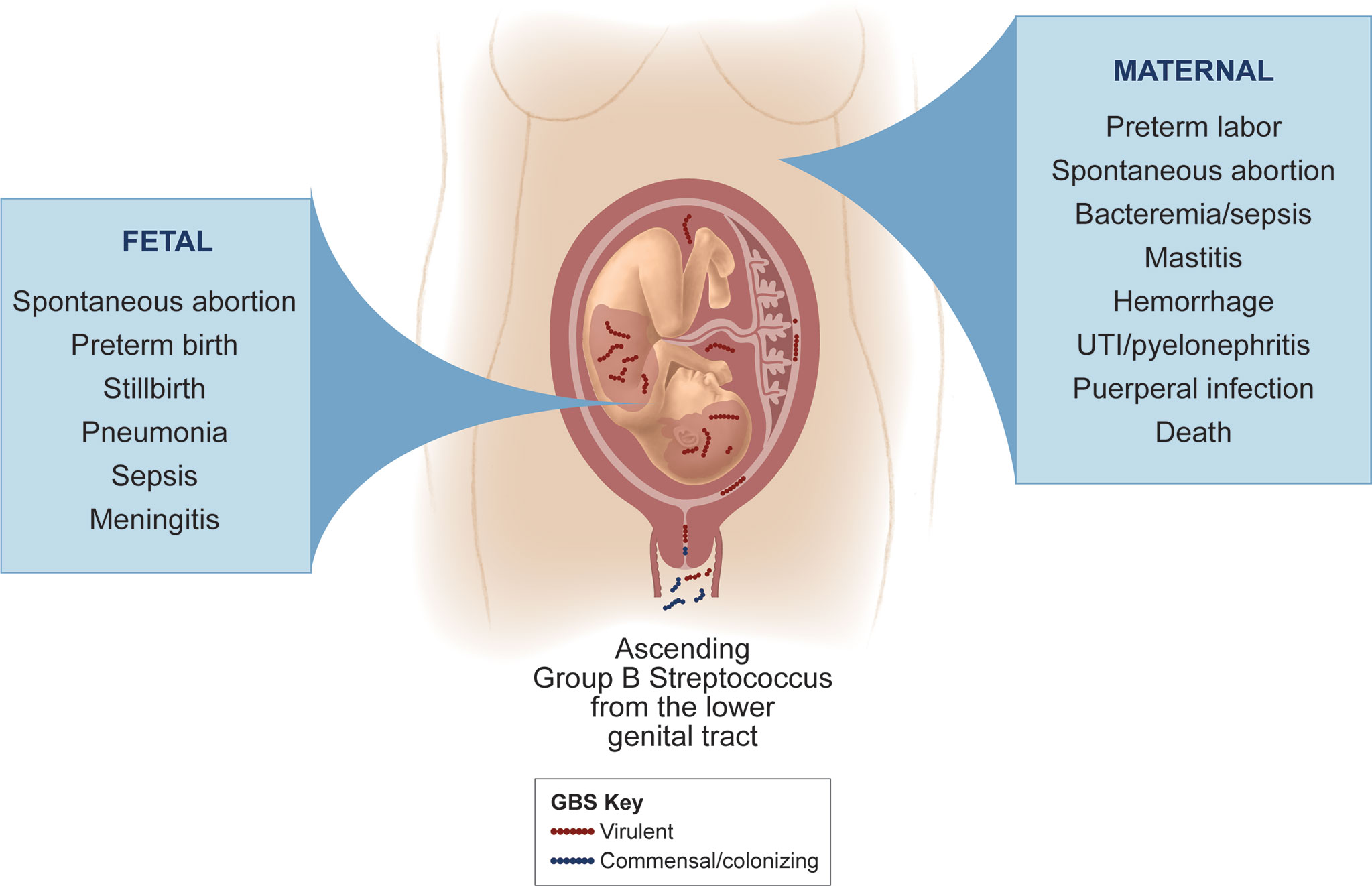 Frontiers | Bacterial And Host Determinants Of Group B Streptococcal Vaginal Colonization And Ascending Infection In Pregnancy | Cellular And Infection Microbiology