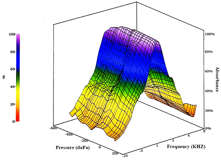 Frontiers The Role of Wideband Tympanometry in the Diagnosis of
