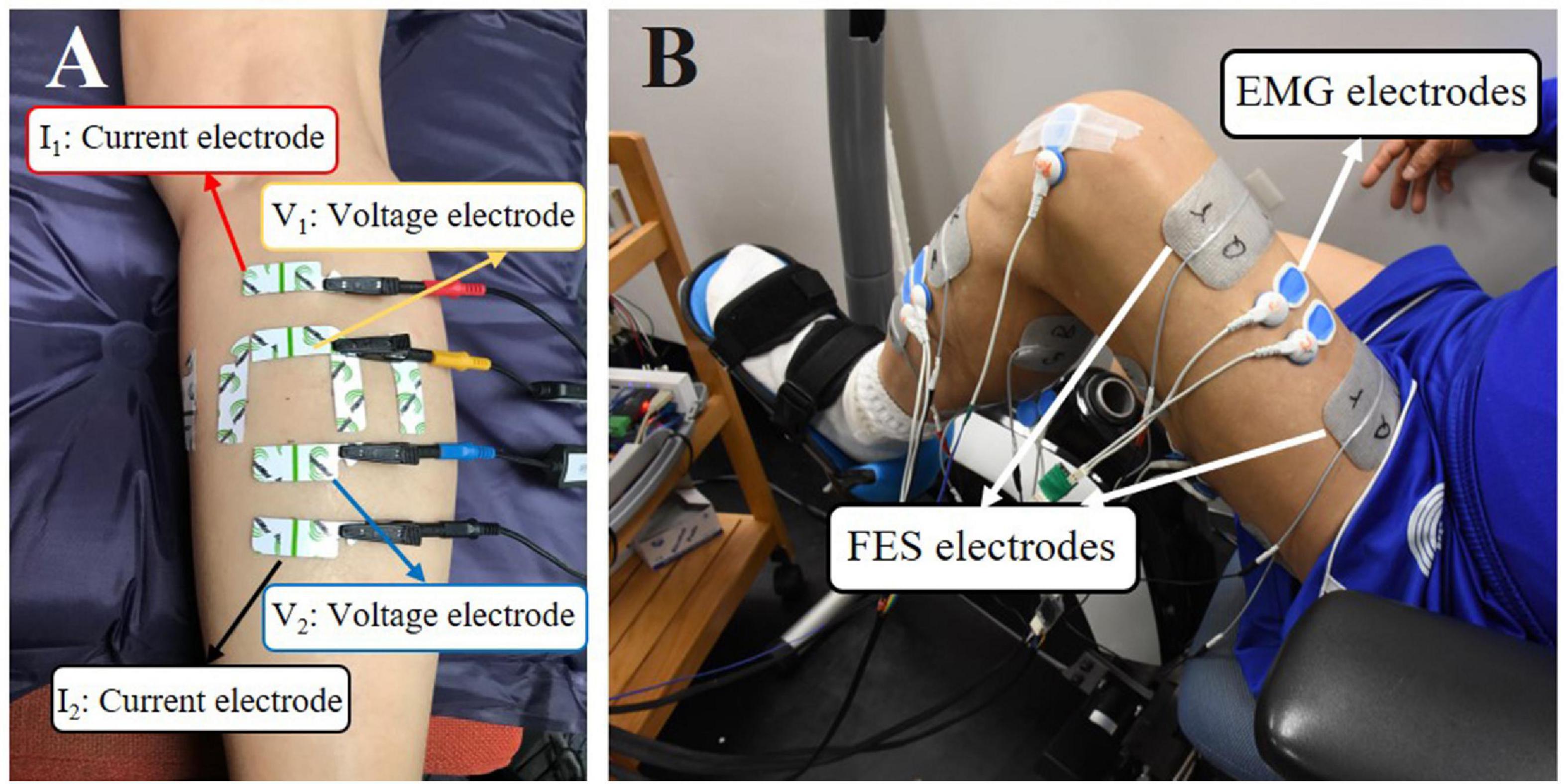 Frontiers Immediate Effects of Functional Electrical Stimulation