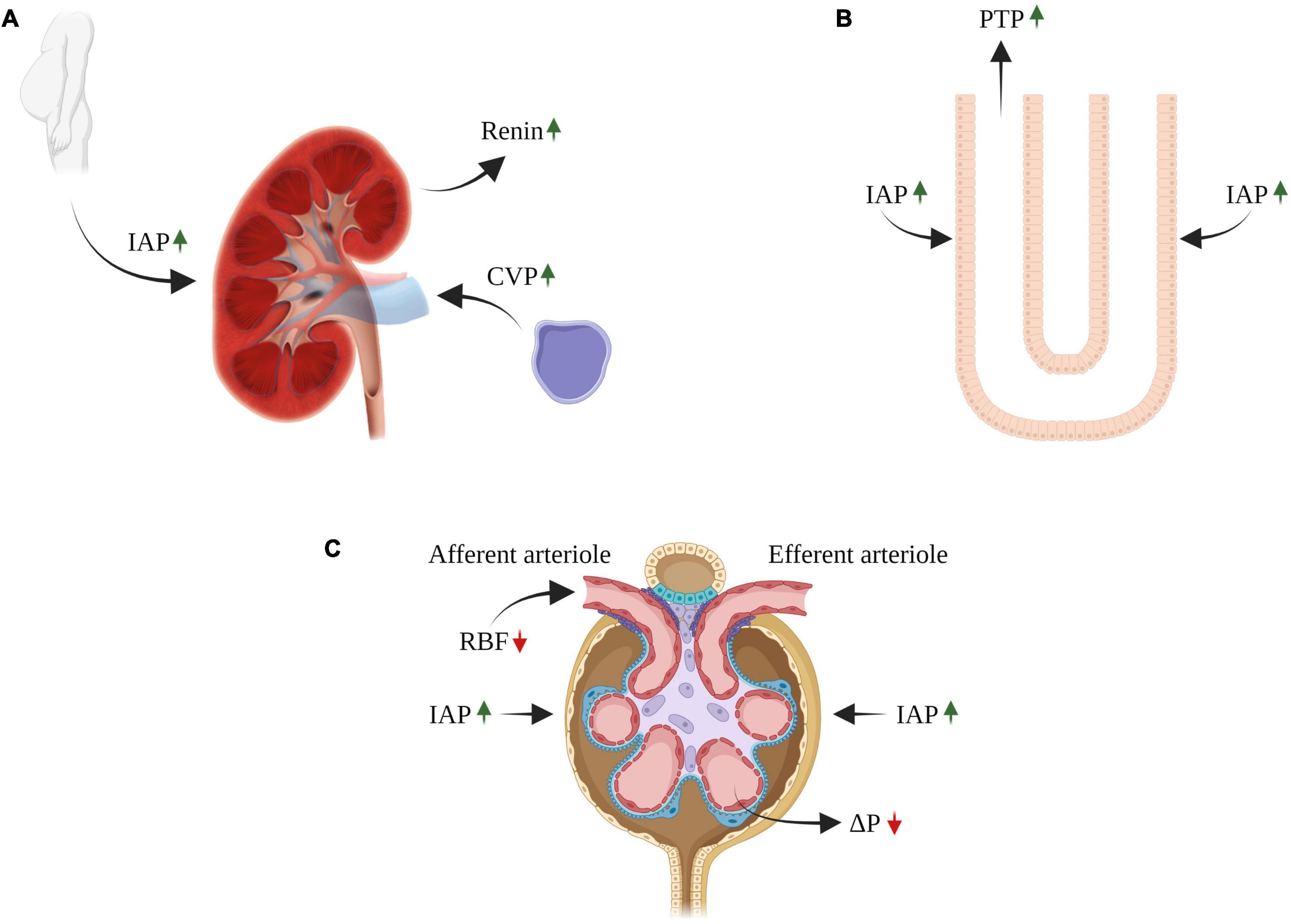 Frontiers Edema formation in congestive heart failure and the