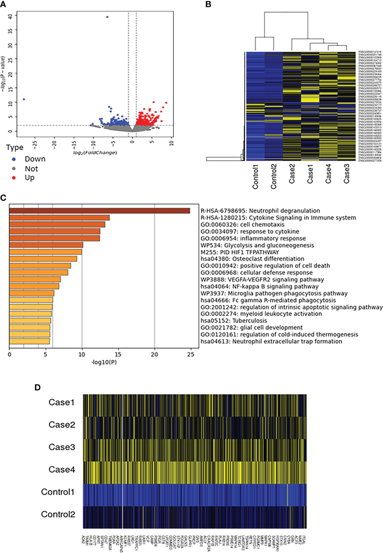 Frontiers Four cases of cytokine storm after COVID19 vaccination