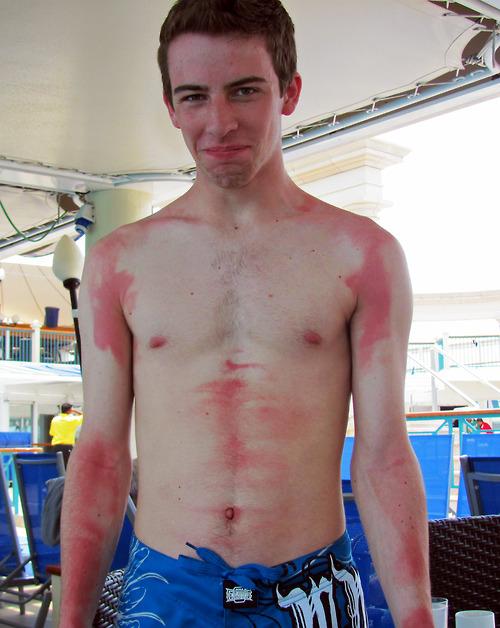 20 Epic Tanning Fails FunCage