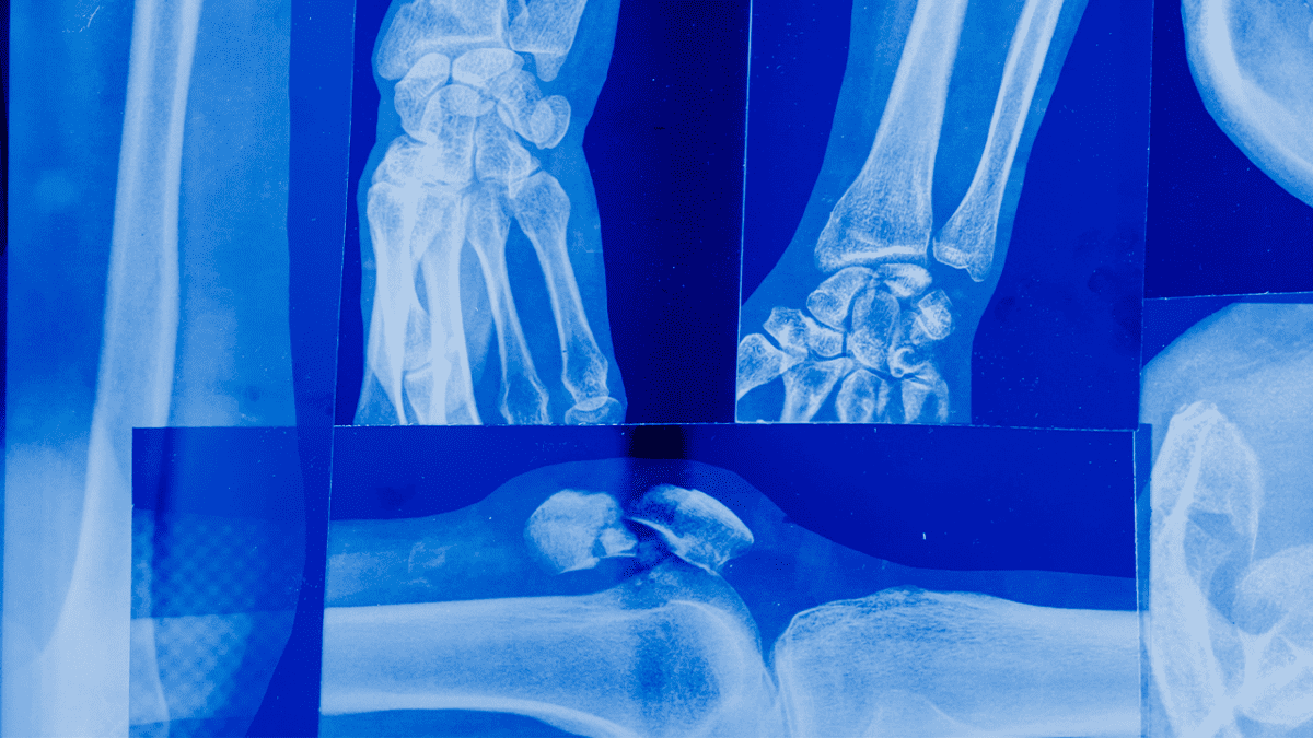 A to Z of Engineering X is for XRays Fun Kids the UK's children's