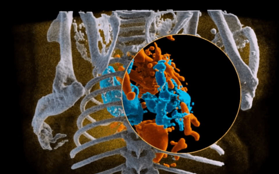 World’s First Full Color 3D XRays Technology To See Human Body