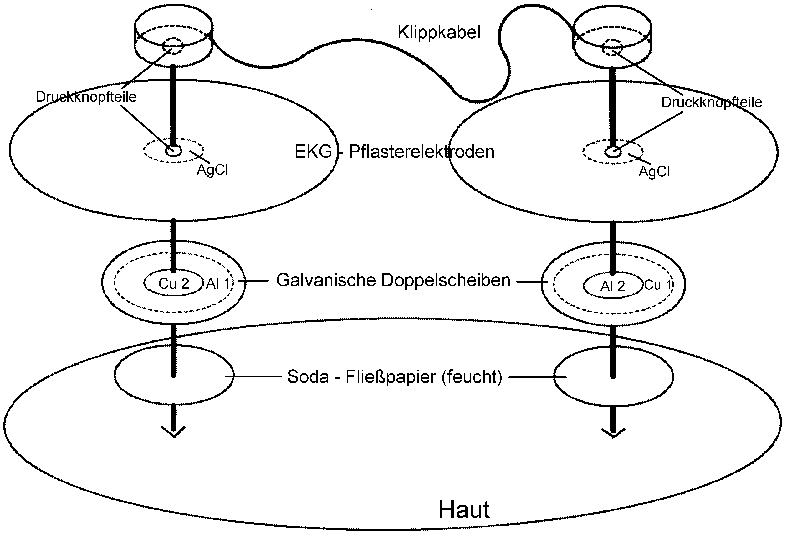 Gentle direct (galvanic) current (electrotherapy and pain therapy) from
