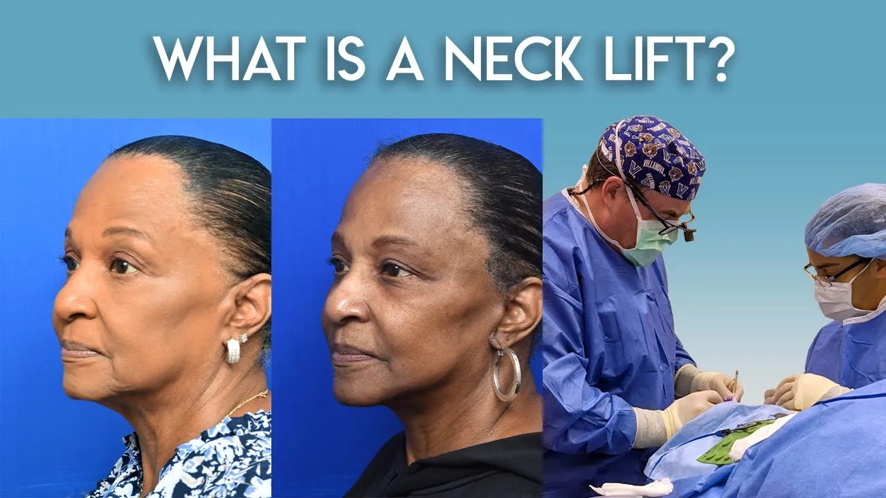 Neck Lift Jacksonville, FL Ponte Vedra Beach Neck Lift
