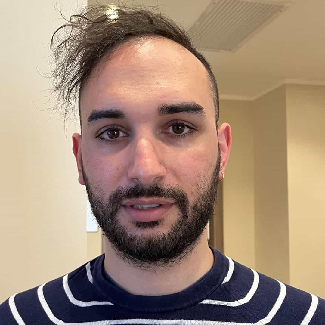 Laser Occhi Milano dr. Gaspare Monaco