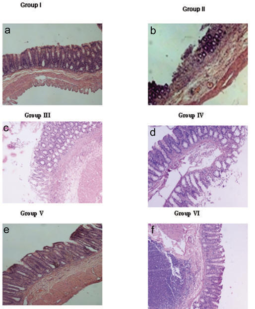 Human Epidermal Growth Factor Alleviates Gastric Antral
