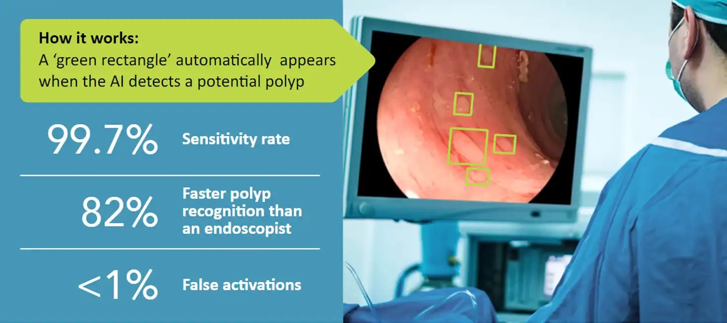 AI Enhanced Colonoscopies Gastroenterology of the Rockies