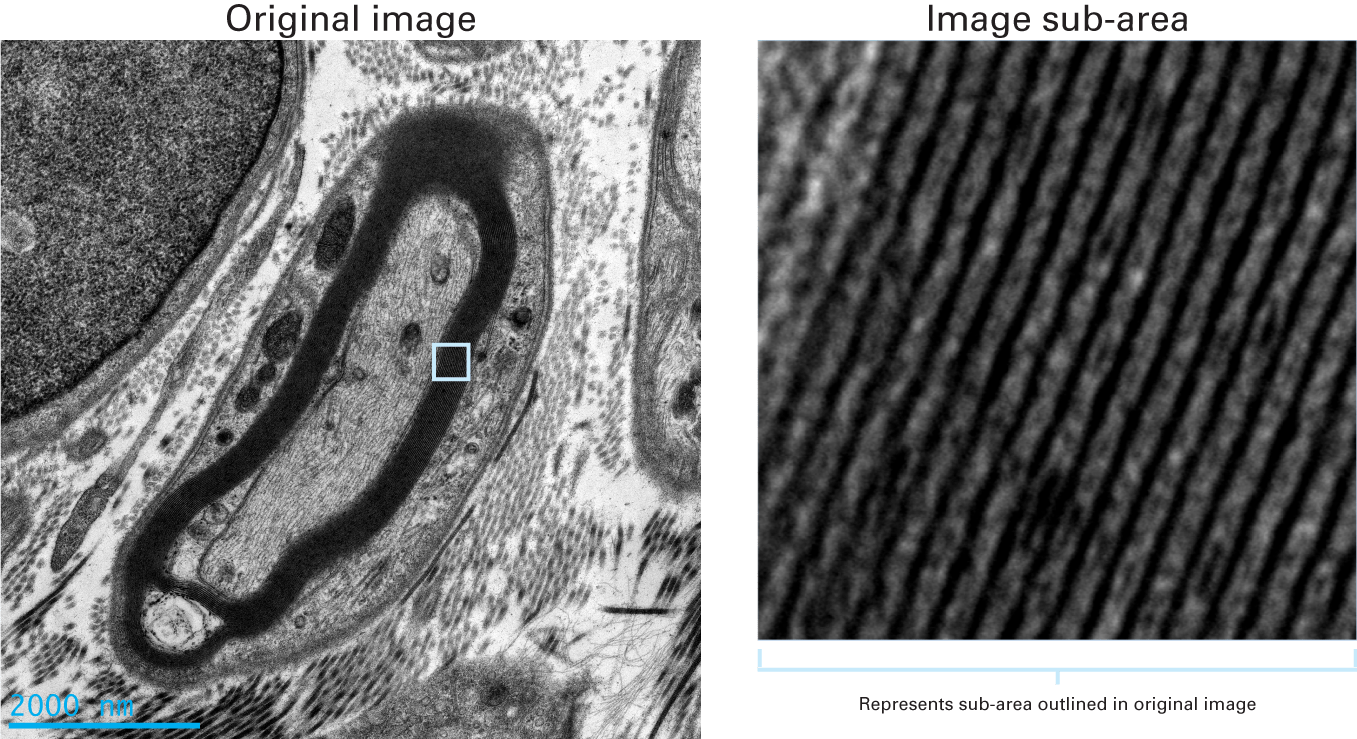 Clearly resolved myelin sheaths and collagen fibers Gatan, Inc.