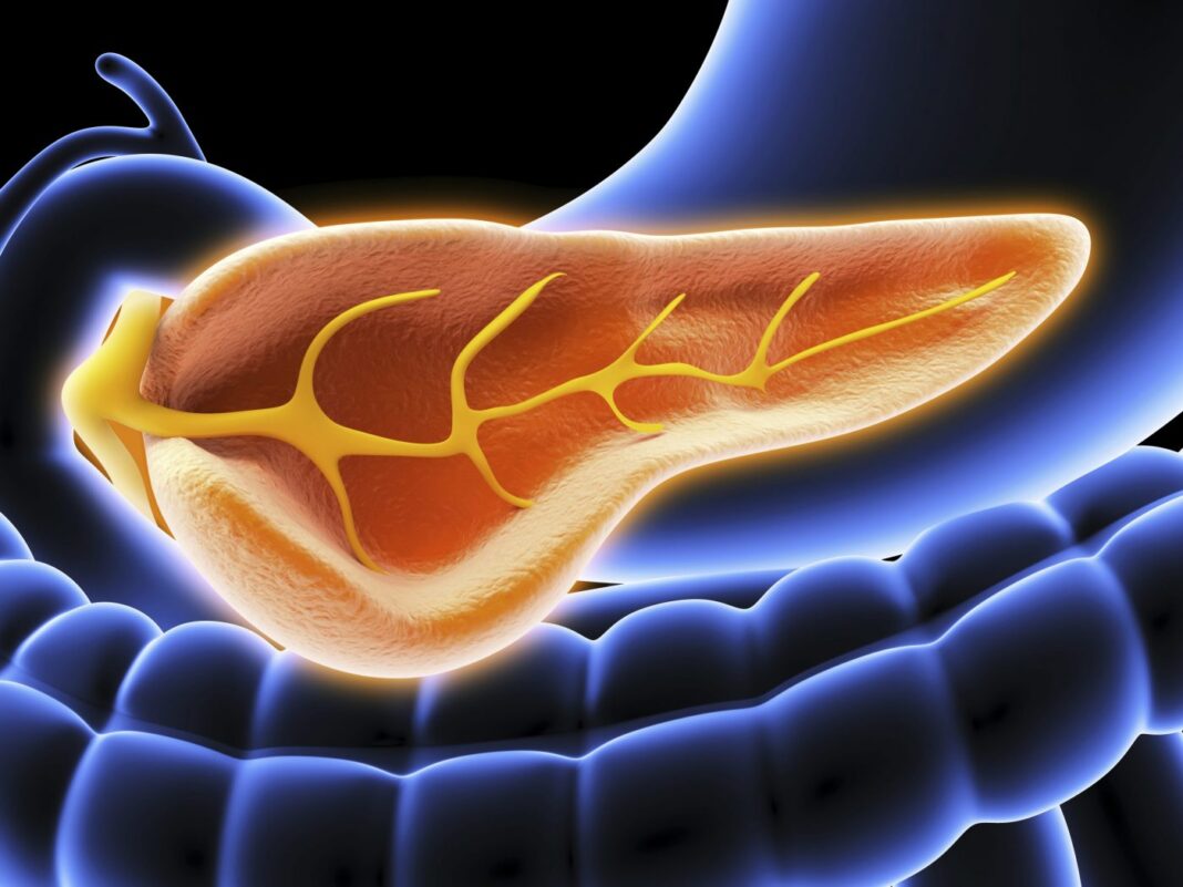 Type 2 Diabetes Triggered by Overspill of Fat from Liver into Pancreas