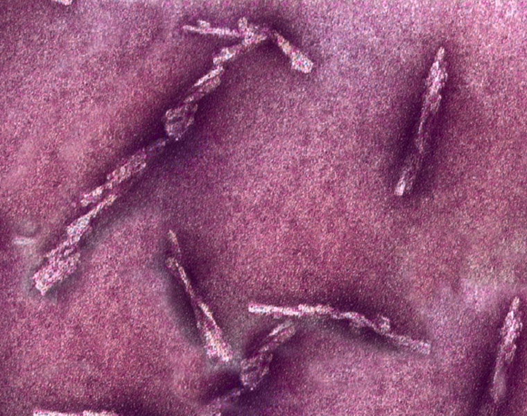 AtomicLevel Imaging of Lethal Prions Offers up New Insights for Potential Therapeutic Targeting