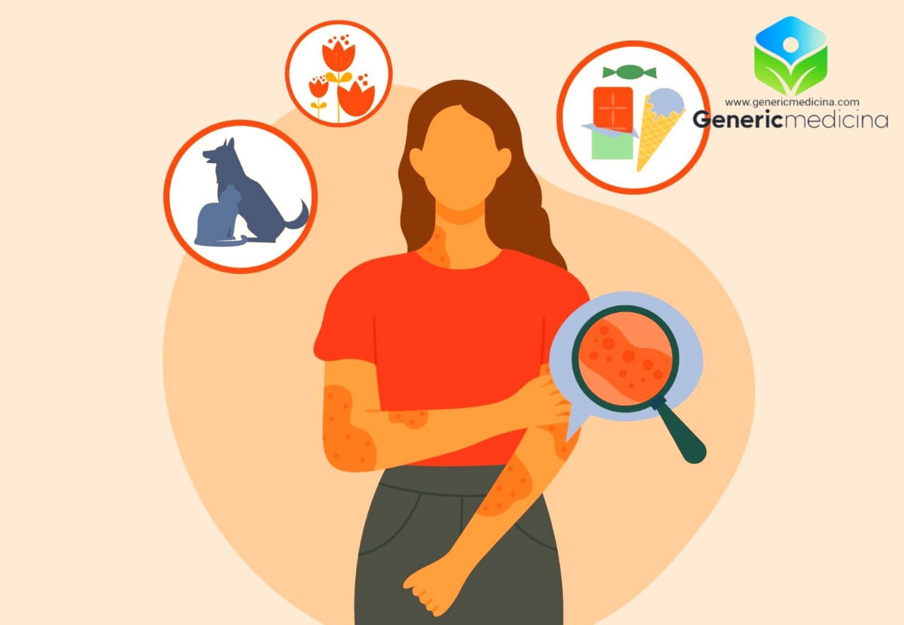 What Is Allergy, Causes, Symptoms, Precautions & Treatments