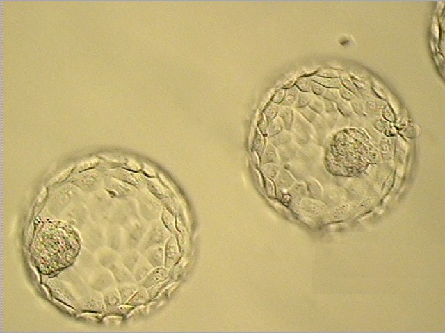 Understanding Embryo Grading Genesis Fertility New York