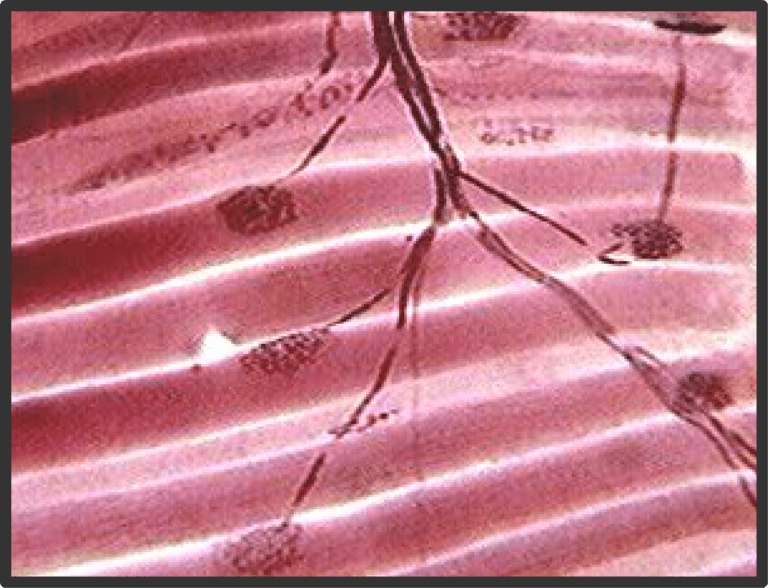 Motor unit definition and diagram GetBodySmart
