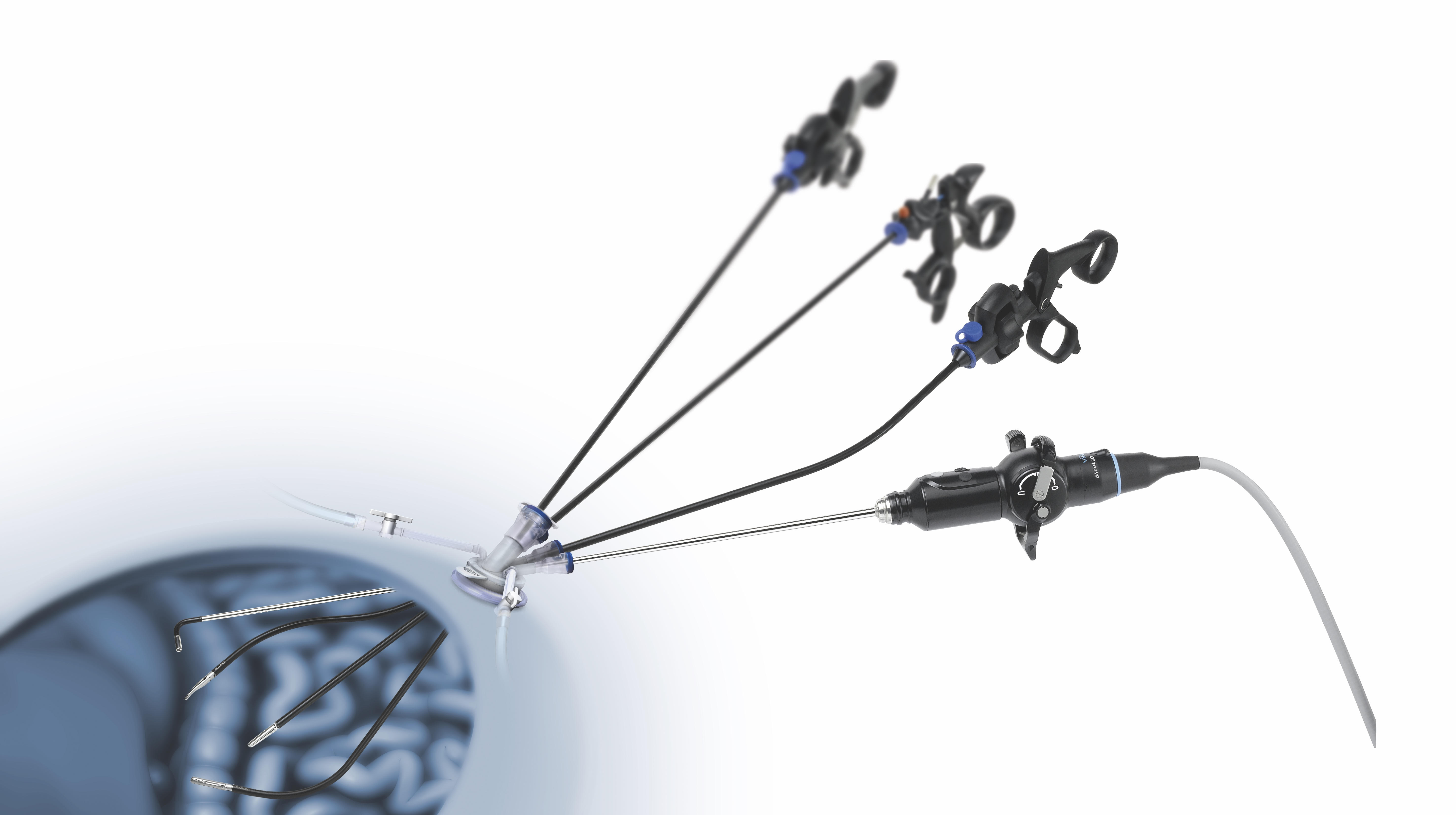 What is Single Incision Laparoscopy? GetDoc