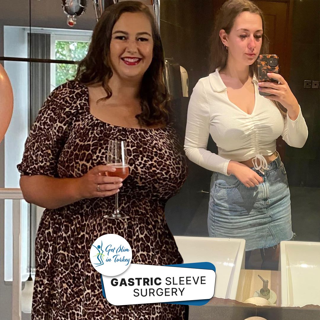 Get Slim in Turkey Home