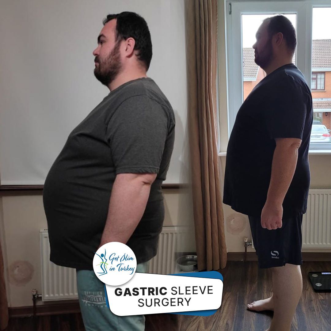 Get Slim in Turkey Home