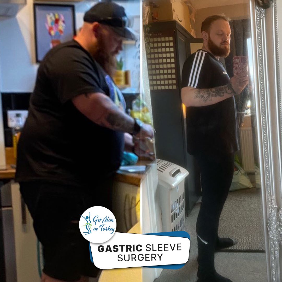 Get Slim in Turkey Home