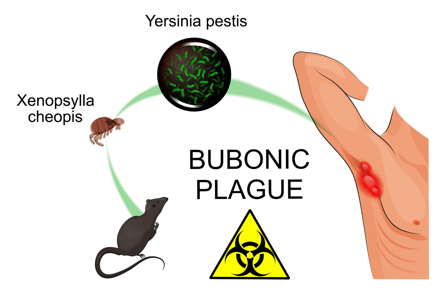 Pathogen of the Month Yersinia Pestis GIDEON Global Infectious