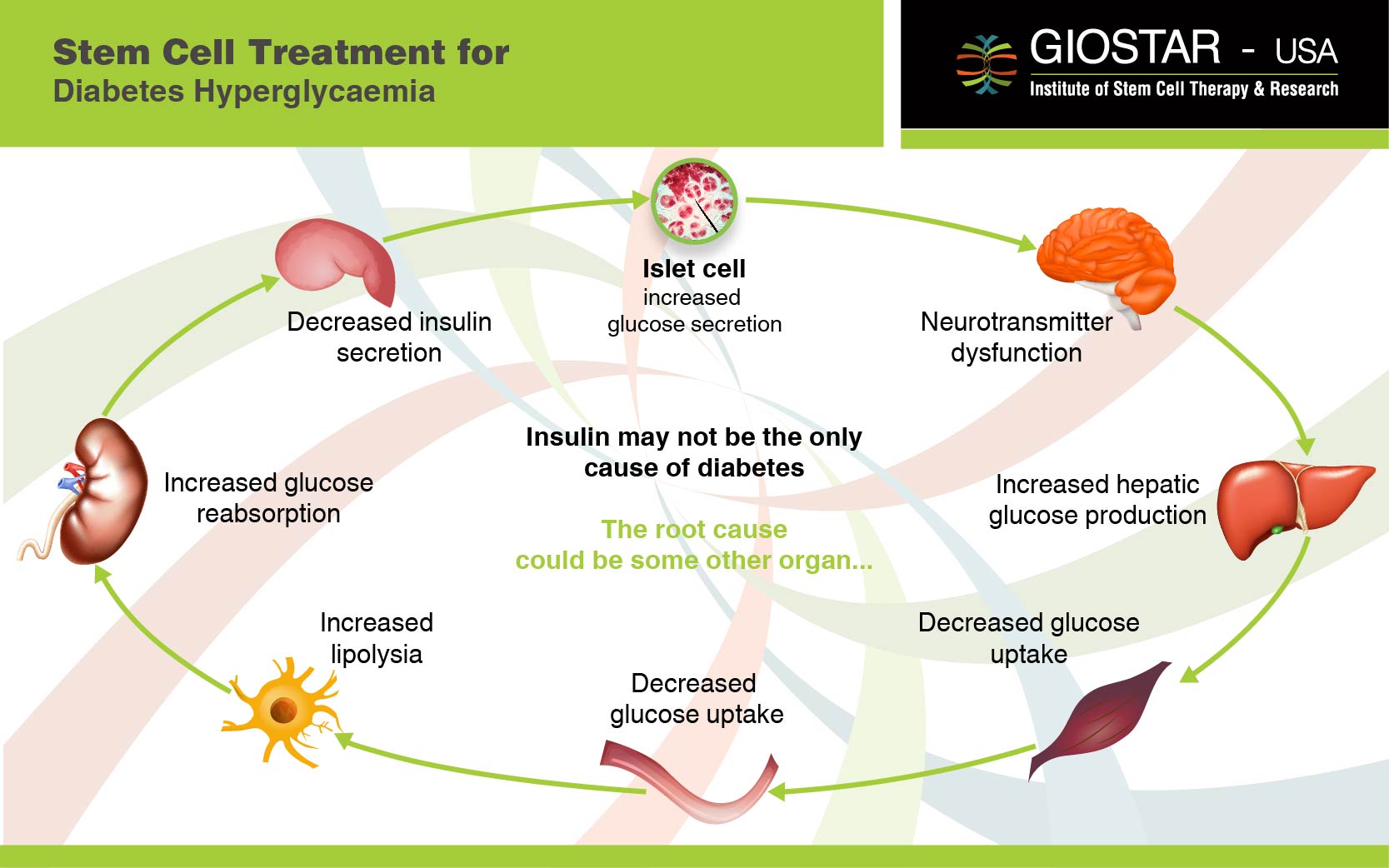 Diabetes Type 1 Treatment in India, Stem Cell Therapy for Diabetes Type 1