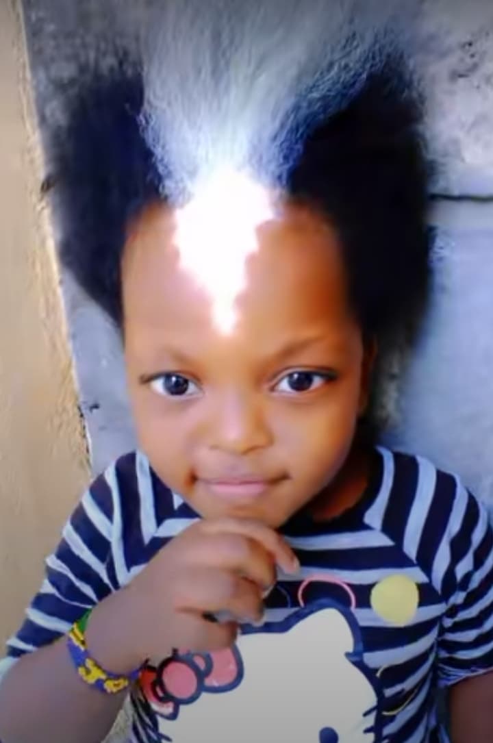 “Lightning goddess” Little girl with unique shiny birthmark and white