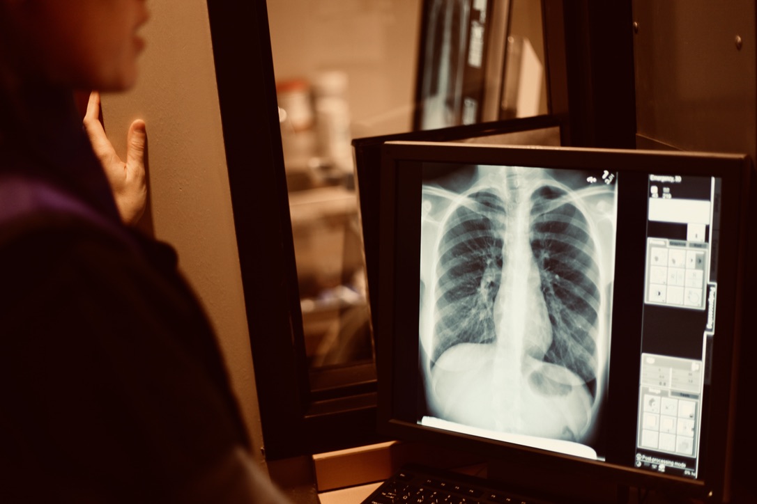 How Long Does an XRay take? Our Blog