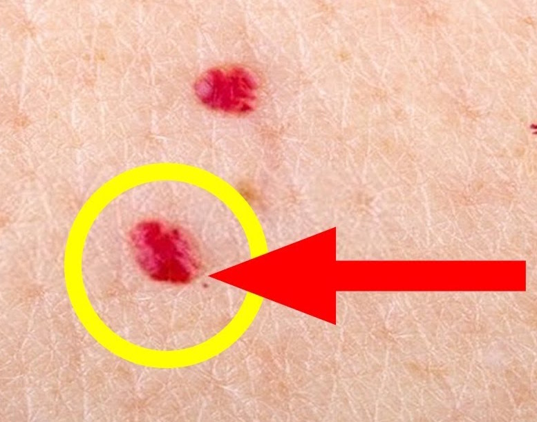 Find out what's behind the red spots that appear on the skin