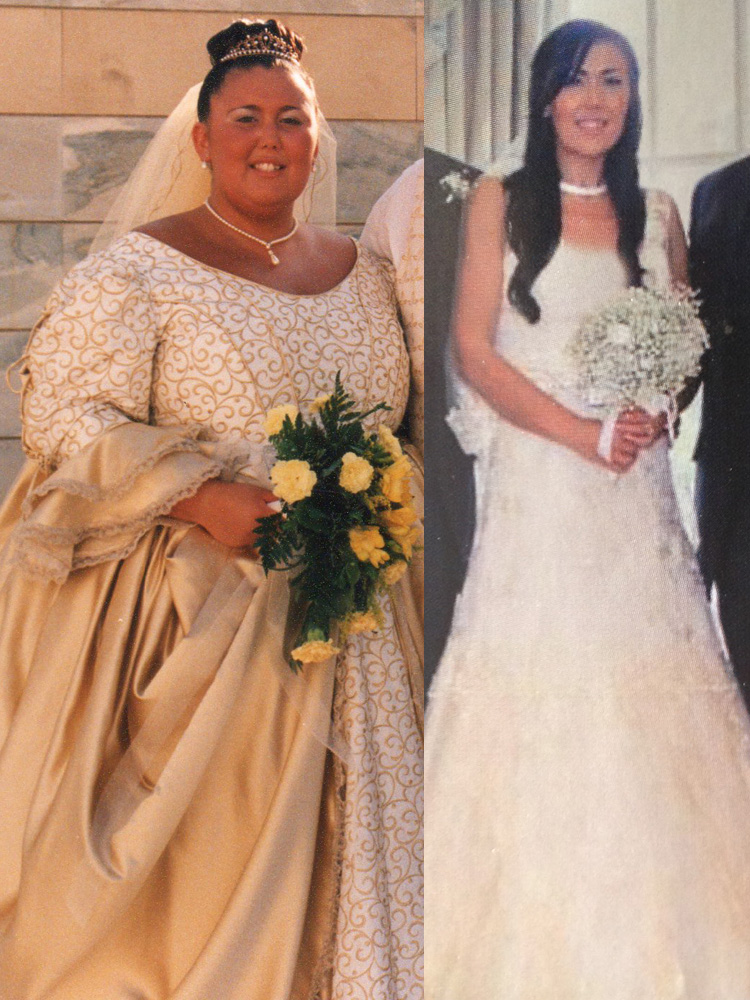 Bridal Weight Loss How To Lose Weight For Wedding in 6 months Groom Weight Loss Stories