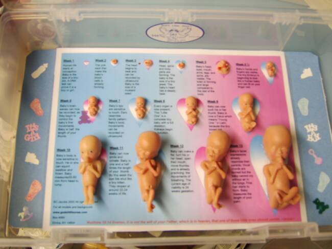Micro Preemies