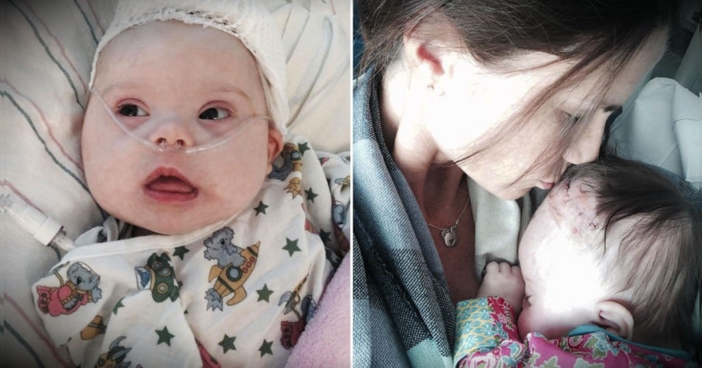 Baby With Inoperable Brain Tumor Gets A Miracle After Much Prayer