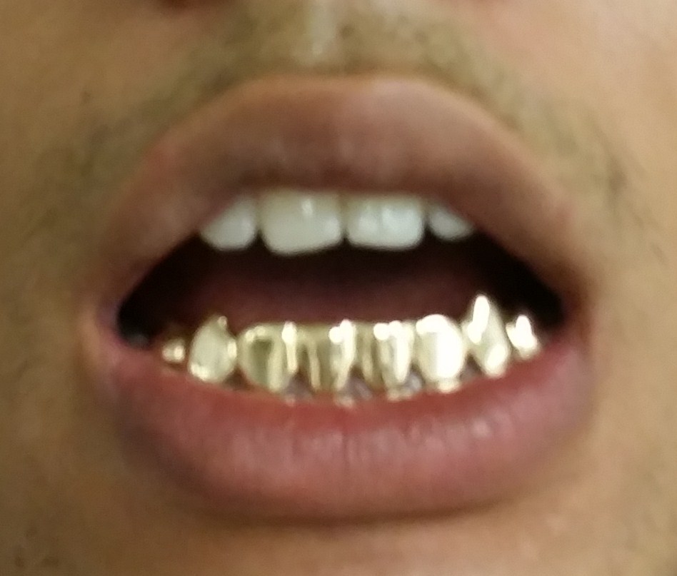 Gold Grillz Miami