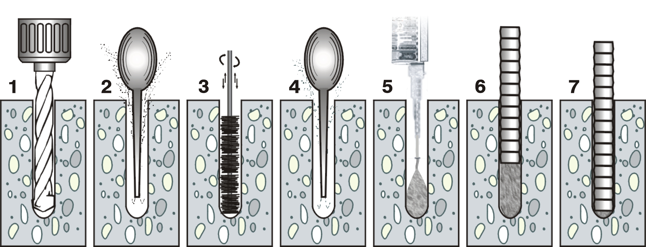 Complete system for injection technology and Chemical Anchors