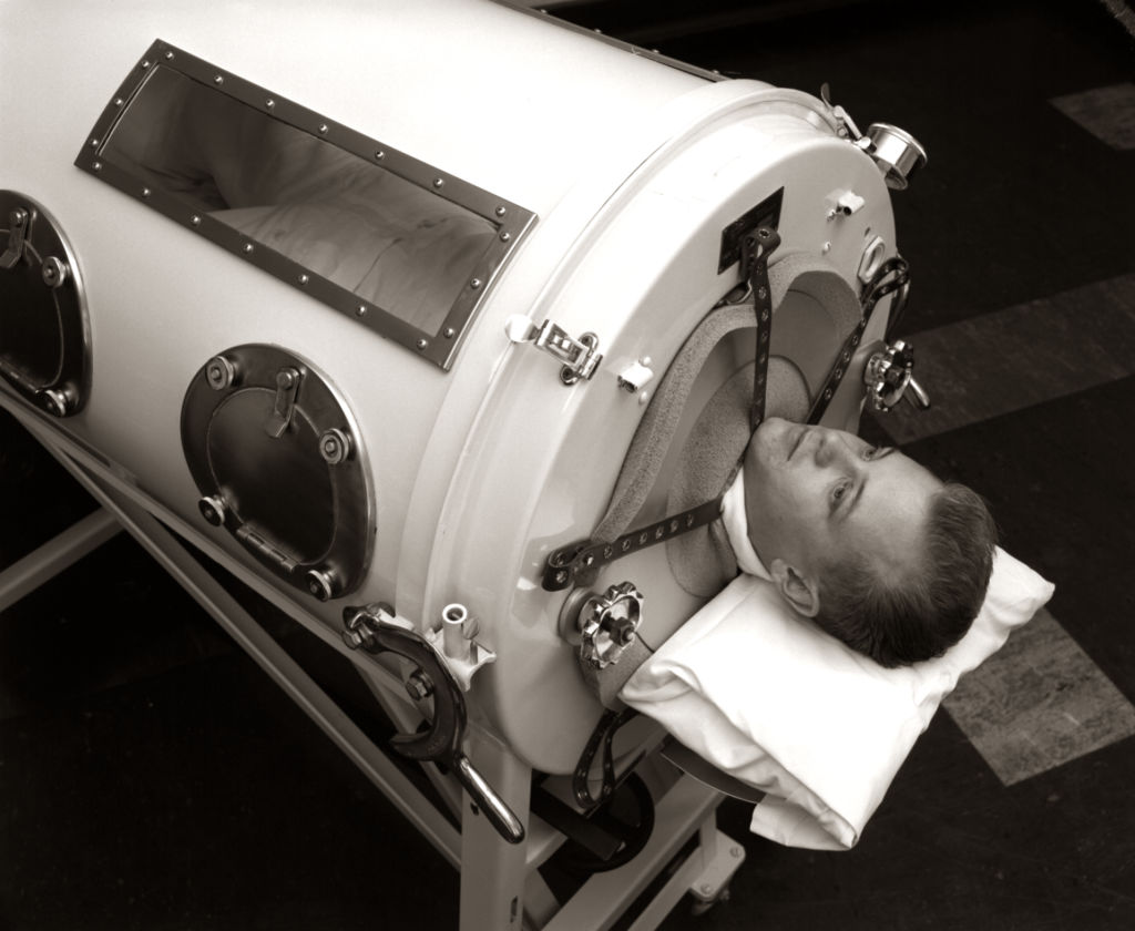 One of the last persons with an iron lung is a 76yearold guy who was