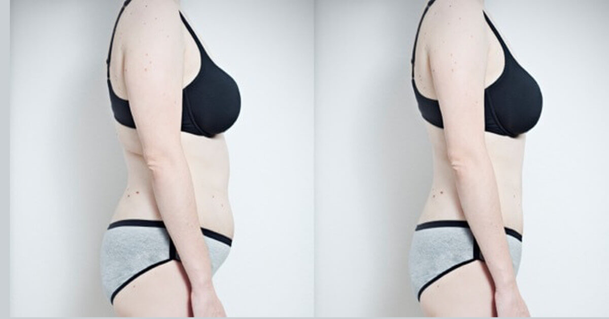 Bauch weg! 10 einfache Tipps (ohne Übungen oder Diät)