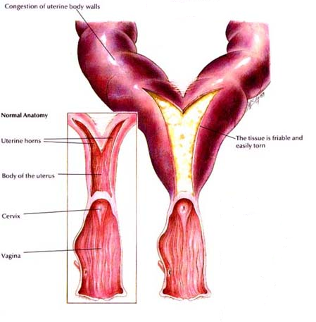 Pyometra Surgery - Granada Veterinary Clinic