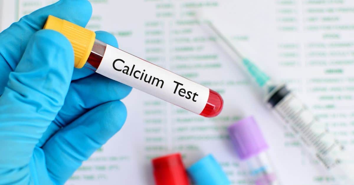 Calcium Lab Values Understanding the Results