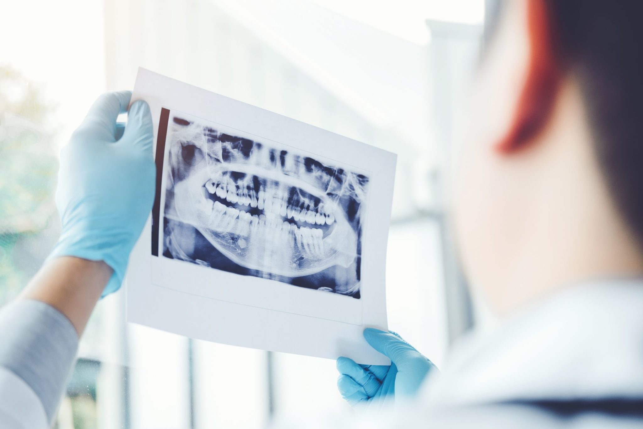 Why Test the Vitality of Tooth Pulp? Greeley, CO Dentist