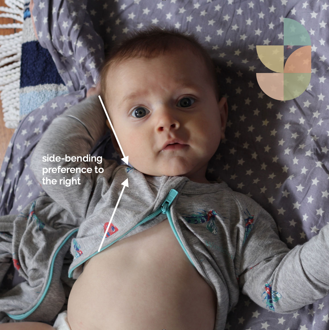 Flat Head Syndrome When to Worry & What to Do Growing Bones